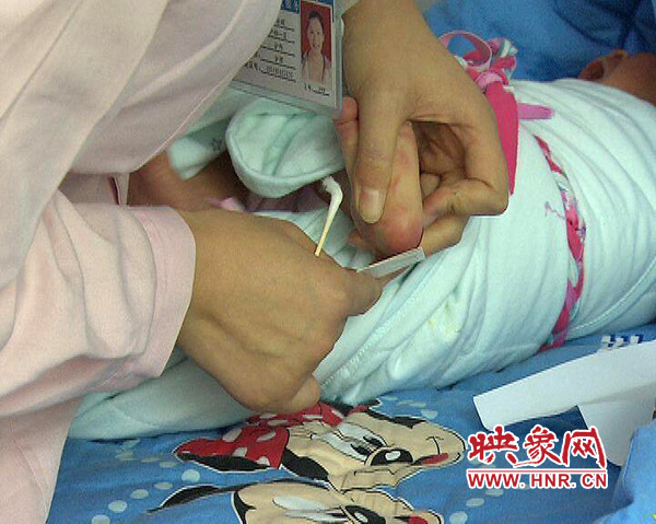 醫(yī)護(hù)人員在為一名新出生嬰兒采足跟血，做疾病篩查