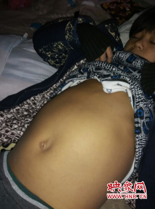 寧陵少年患病十幾年仍堅(jiān)持上學(xué) 無(wú)錢治病盼救助