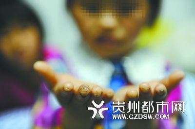 指尖被針扎得傷痕累累。