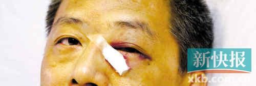 ■這起醫(yī)鬧事件，受傷的遠(yuǎn)遠(yuǎn)不只是熊旭明醫(yī)生的身體。