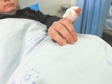實習(xí)醫(yī)生陳洪左手的小拇指肌腱斷裂。