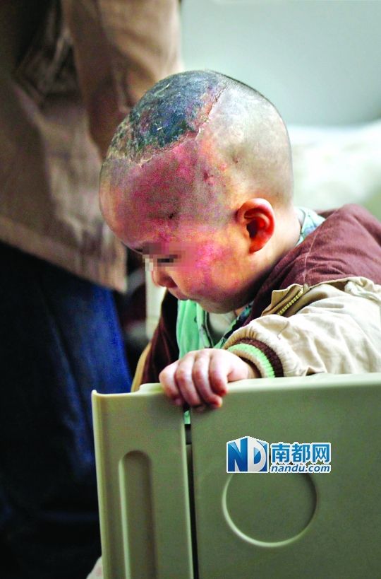 1月8日下午，小寶頭上和臉上都是傷痕。