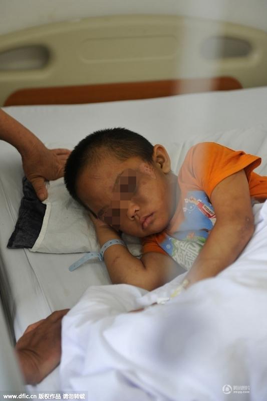 圖為全身傷痕累累的小進(jìn)。