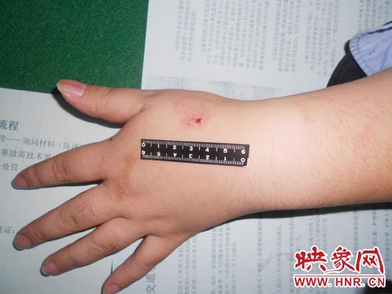 為幫助無證駕駛的朋友逃避處罰，新鄉(xiāng)的王某竟對執(zhí)勤民警大打出手，還將一名民警的手臂咬傷