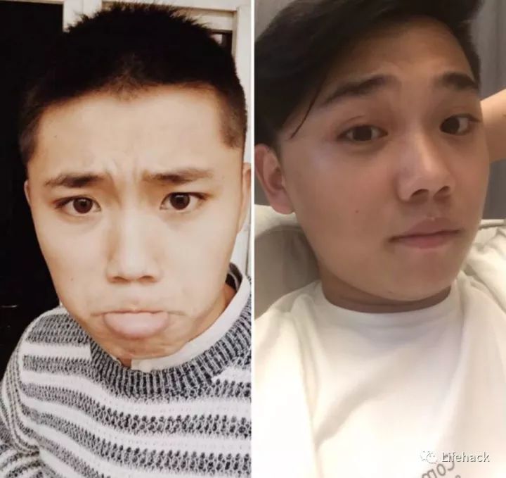 長胖20斤，臉型怎么變？這些例子看完扎心了！