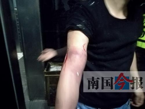 覃先生手臂被卡的部位受傷流血，所幸傷勢無大礙。 通訊員 王建民 攝