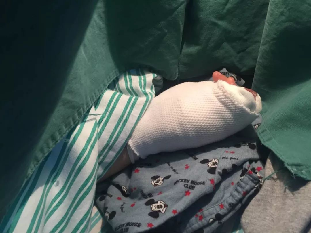 嚇哭！6歲男孩被夾斷手指 罪魁禍首竟是校服