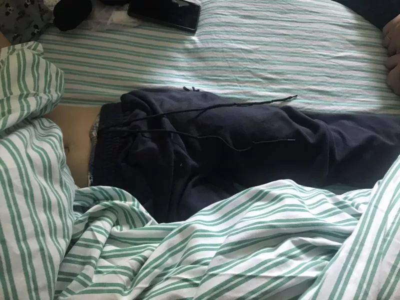 嚇哭！6歲男孩被夾斷手指 罪魁禍首竟是校服