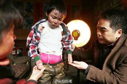 男孩皮膚一碰就破 裹衛(wèi)生紙堅(jiān)持上學(xué) 男孩皮膚一碰就破 裹衛(wèi)生紙堅(jiān)持上學(xué)