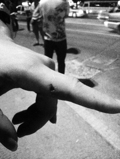 民警食指被咬傷。