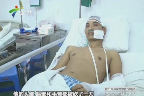 另一名傷者頭部、臉部和手臂都被砍了一刀。(視頻截圖)