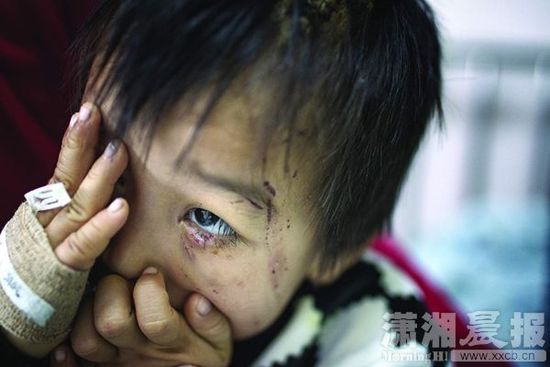 1月13日，湖南省兒童醫(yī)院，4歲的源源用手蒙住了眼睛。