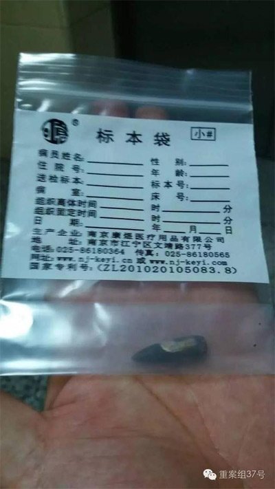 經(jīng)警方鑒定，秦女士體內(nèi)取出的子彈系56式步槍射出 。 受訪者供圖