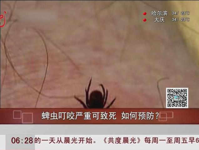 蜱蟲叮咬嚴重可致死如何預防？