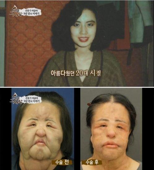 美女整容變“電風(fēng)扇大媽” 盤點(diǎn)整容失敗驚悚案例 美女整容變“電風(fēng)扇大媽” 盤點(diǎn)整容失敗驚悚案例